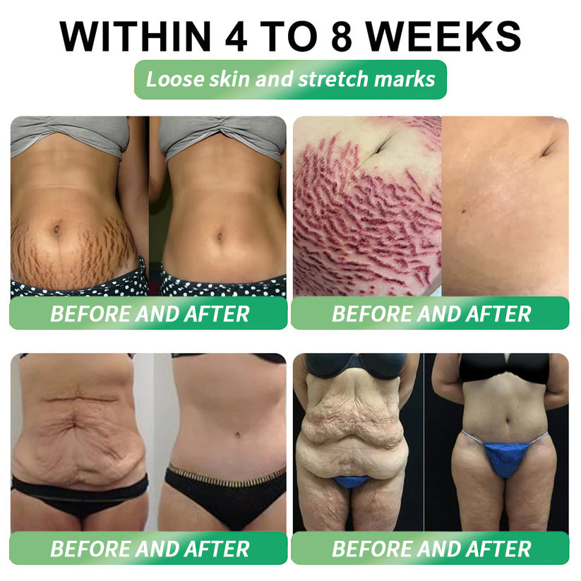 💡𝑶𝒇𝒇𝒊𝒄𝒊𝒂𝒍 𝑺𝒕𝒐𝒓𝒆 | 💯Divifit®🇺🇸𝐺𝐿𝑃-𝟏  𝑺𝒊𝒙-𝒊𝒏-𝑶𝒏𝒆 𝑯𝒆𝒂𝒍𝒕𝒉 𝑺𝒐𝒍𝒖𝒕𝒊𝒐𝒏 𝑶𝒓𝒂𝒍 𝑳𝒊𝒒𝒖𝒊𝒅  (𝐉𝐮𝐬𝐭 𝐨𝐧𝐜𝐞 𝐚 𝐝𝐚𝐲, 𝐯𝐢𝐬𝐢𝐛𝐥𝐞 𝐜𝐡𝐚𝐧𝐠𝐞𝐬 𝐢𝐧 𝟕 𝐝𝐚𝐲𝐬） ✅ 𝐅𝐨𝐫 𝐨𝐛𝐞𝐬𝐢𝐭𝐲, 𝐜𝐚𝐫𝐝𝐢𝐨𝐯𝐚𝐬𝐜𝐮𝐥𝐚𝐫 𝐡𝐞𝐚𝐥𝐭𝐡, 𝐝𝐢𝐚𝐛𝐞𝐭𝐞𝐬, 𝐬𝐥𝐞𝐞𝐩 𝐚𝐩𝐧𝐞𝐚, 𝐆𝐮𝐭 𝐇𝐞𝐚𝐥𝐭𝐡, 𝐣𝐨𝐢𝐧𝐭 𝐢𝐬𝐬𝐮𝐞𝐬, 𝐚𝐧𝐝 𝐦𝐨𝐫𝐞